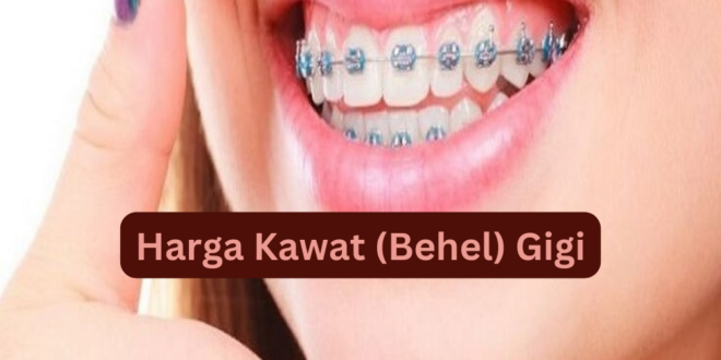 Harga Kawat (Behel) Gigi